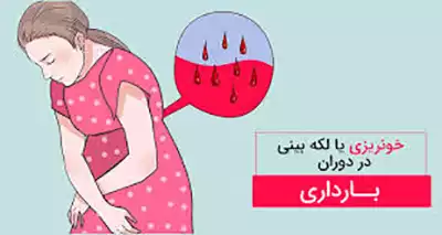 خونریزی در دوران بارداری